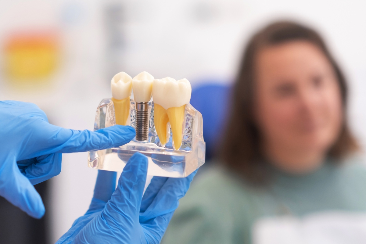How Dental Implants Help Maintain Proper Tooth Alignment