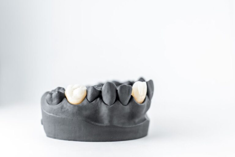 custom dental crowns