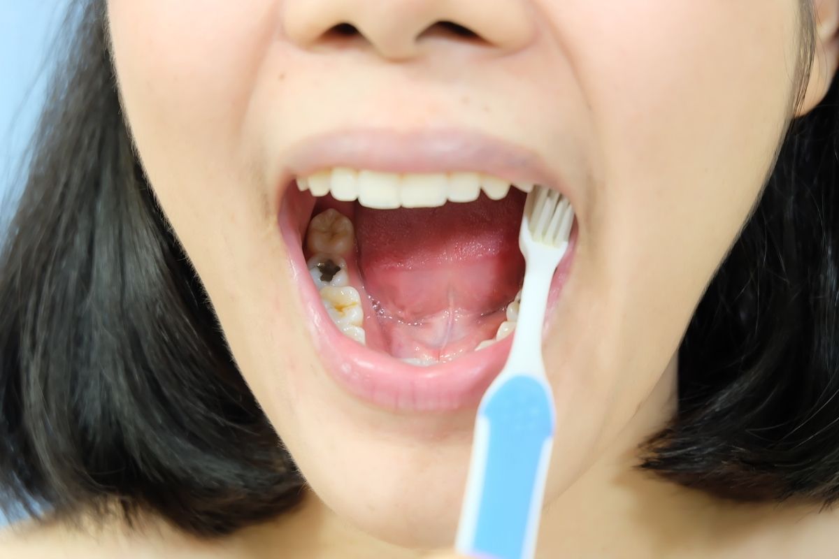Common Dental Problem Residents Face in Winter Springs