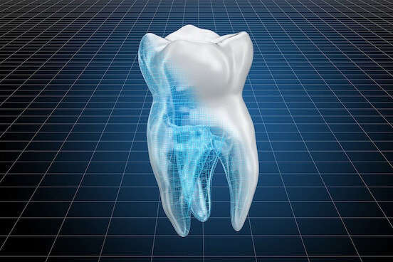 A 3D illustration of a white tooth with one of the roots highlighted by blue light