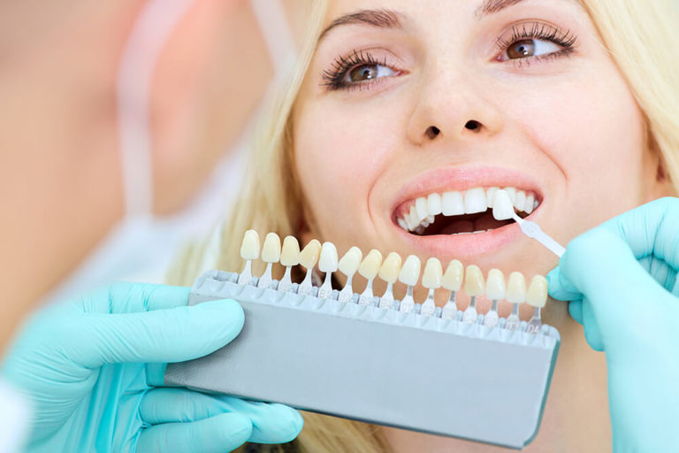 A dentist holds a tooth whitening scale up to a female patient's teeth to compare degrees of whiteness